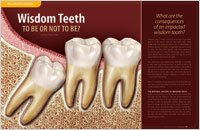 Wisdom Teeth � Dear Doctor Magazine