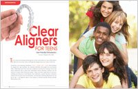 Clear Aligners - Dear Doctor Magazine